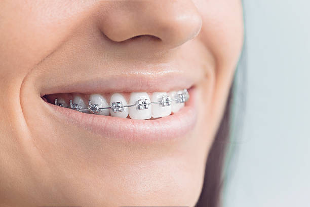 Why Choose Us for Your Dental Needs in Grand Saline, TX